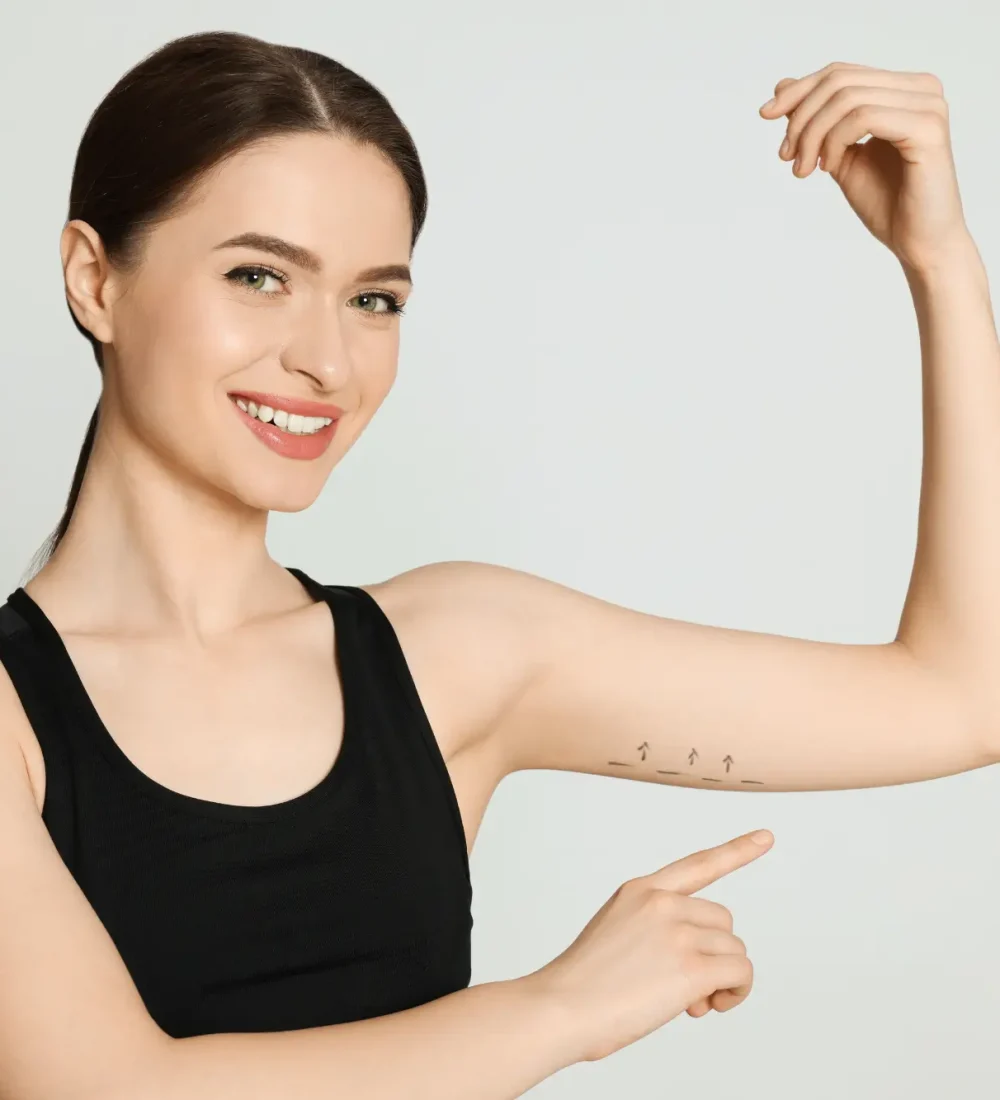 Arm Lift (Brachioplasty)