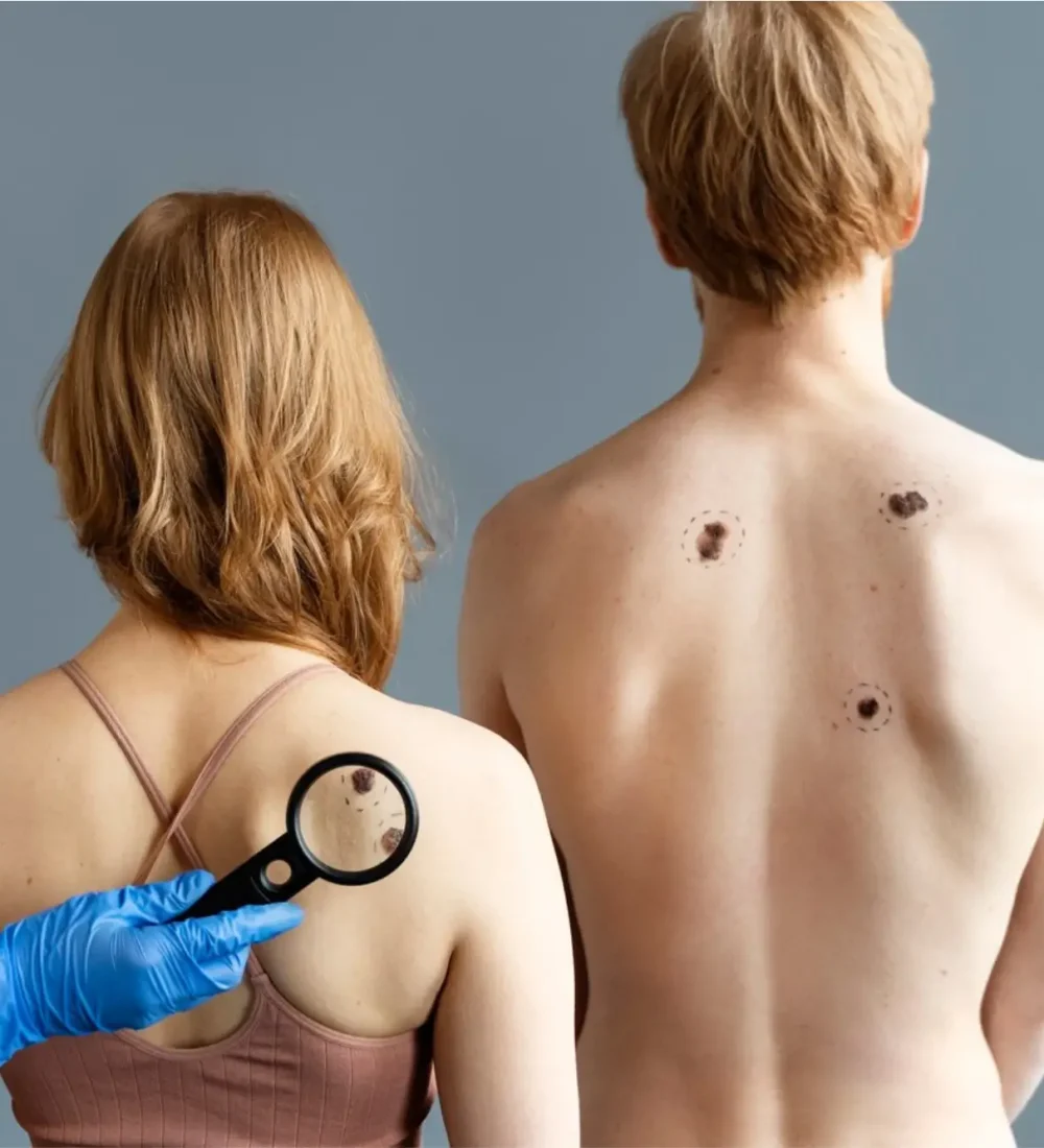 Skin Cancer Excision and Reconstruction